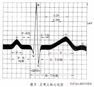 欧洲杯下单平台 欧洲杯正规下单平台(官方)网站/网页版登录地址-心肌缺血有什么症状和表现