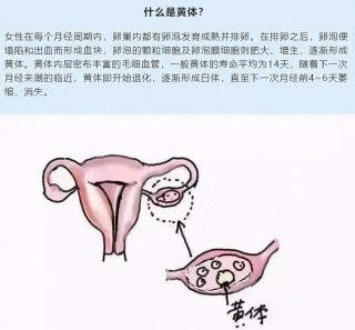 欧洲杯正规下单平台(官方)网站/网页版登录入口/手机版-黄体破裂是什么症状