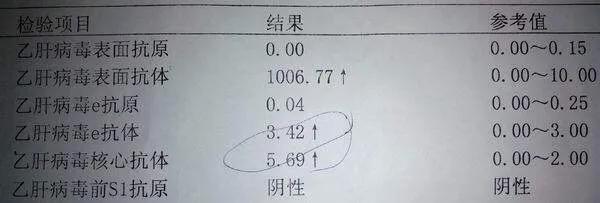 欧洲杯下单平台(官方)APP下载IOS/安卓通用版/手机app下载-乙肝表面抗体阳性是什么意思  第1张