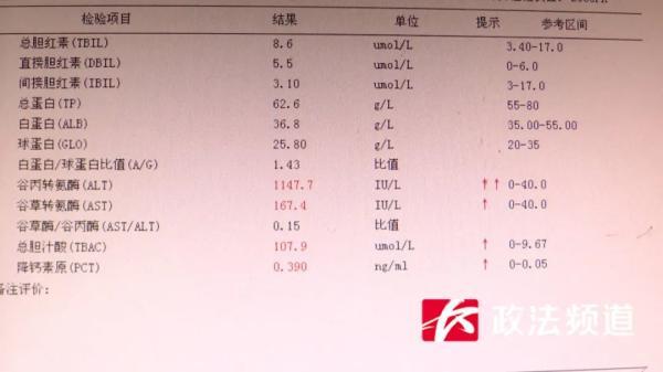 欧洲杯下单平台(官方)APP下载IOS/安卓通用版/手机app下载-谷丙转氨酶偏高说明什么原因  第2张